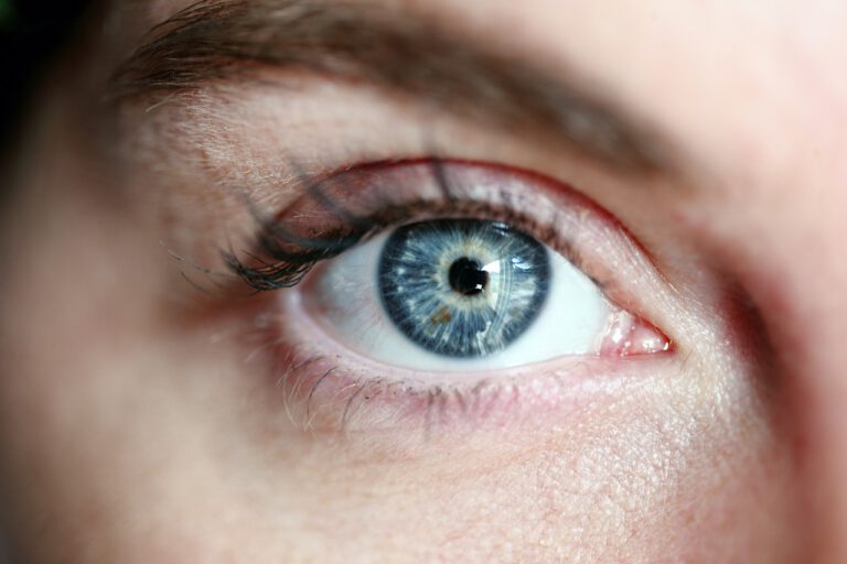 EMDR